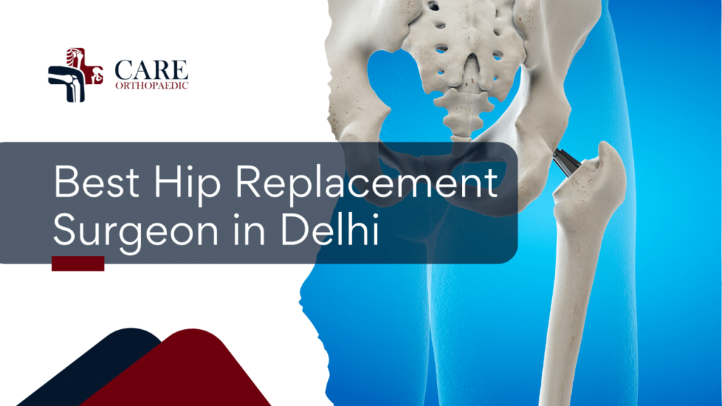 Hip Replacement