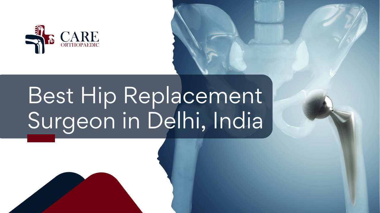 Best Hip Replacement Surgeon in Delhi, India