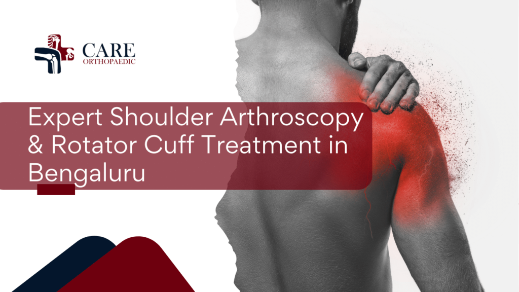 Shoulder arthroscopy rotator cuff and dislocation