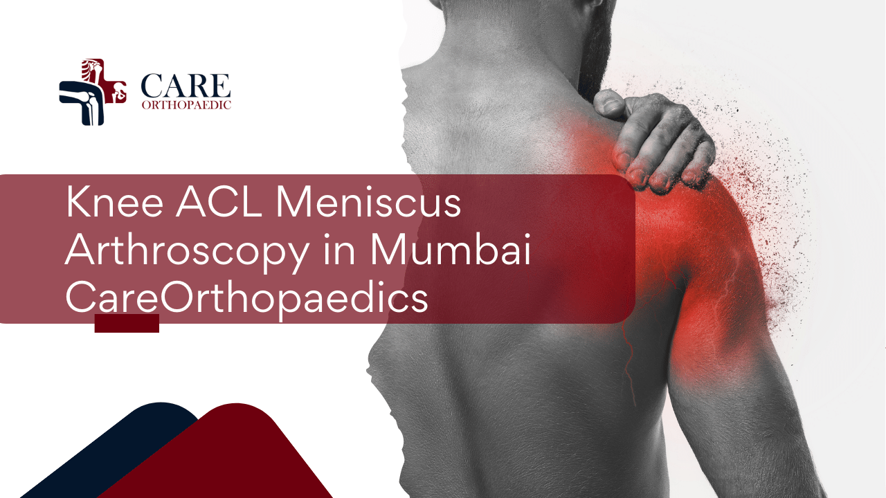 Knee ACL Meniscus Arthroscopy in Mumbai | CareOrthopaedics