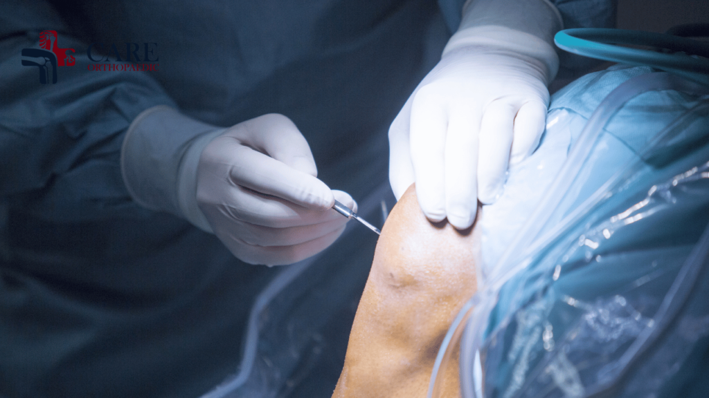 Knee ACL Meniscus Arthroscopy