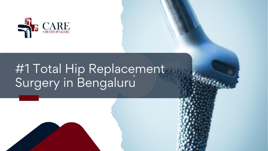 hip replacement