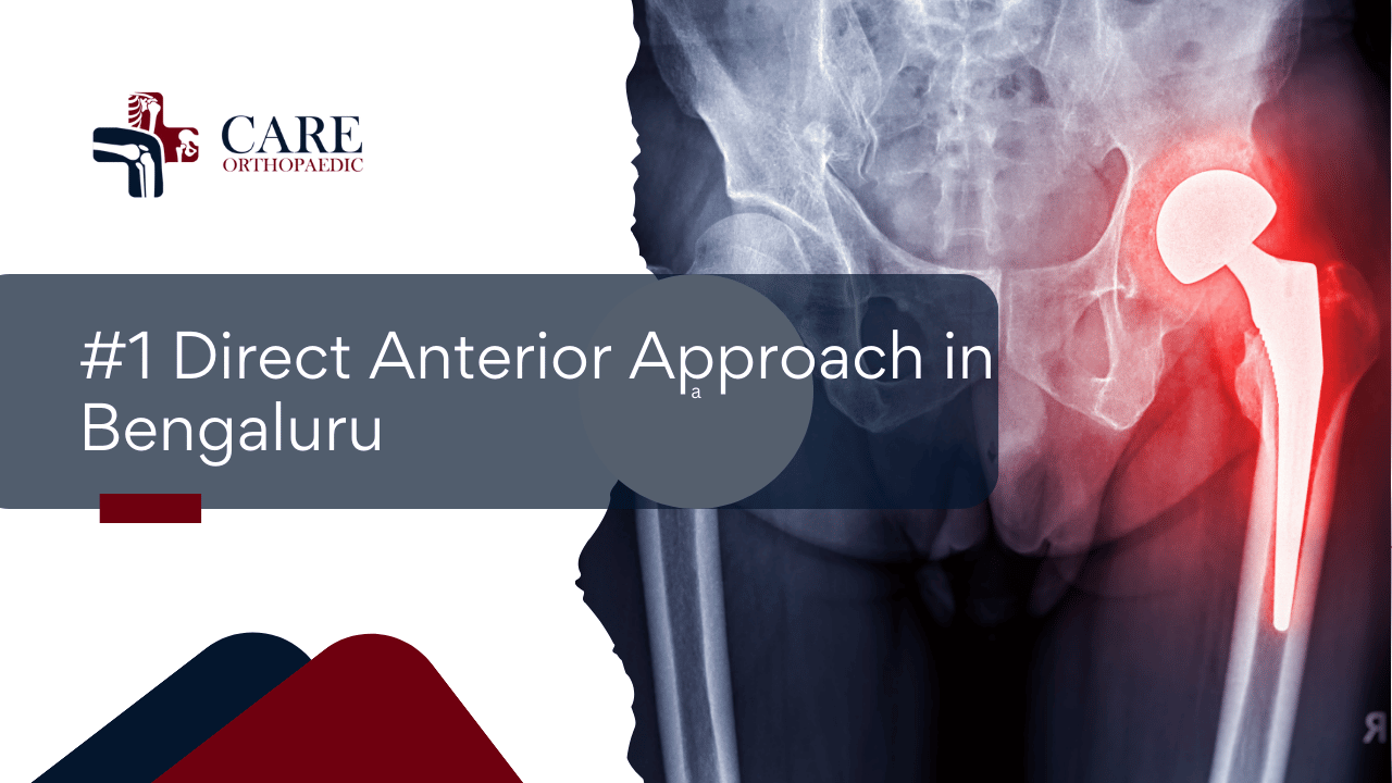 #1 Direct Anterior Approach in Bengaluru