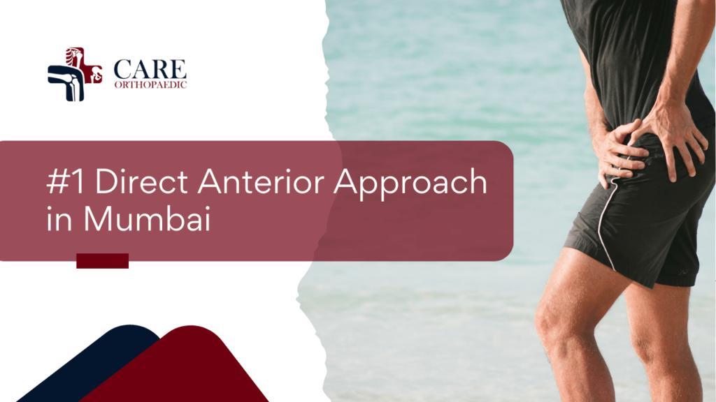 Direct Anterior Approach in Mumbai