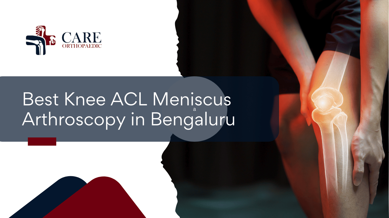 Best Knee ACL Meniscus Arthroscopy in Bengaluru