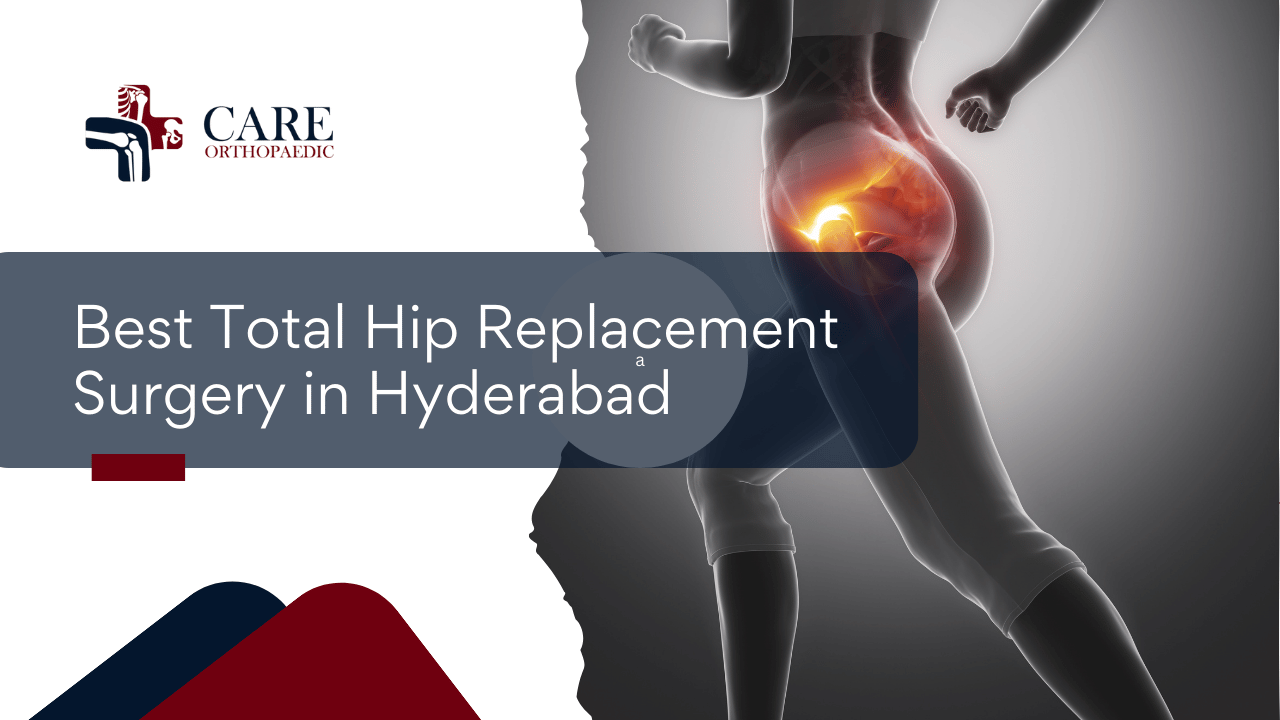 Best Total Hip Replacement Surgery in Hyderabad