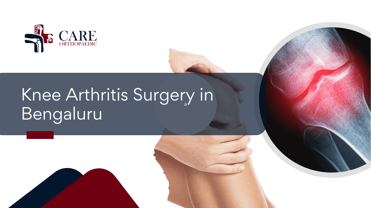 Knee Arthritis Surgery in Bengaluru