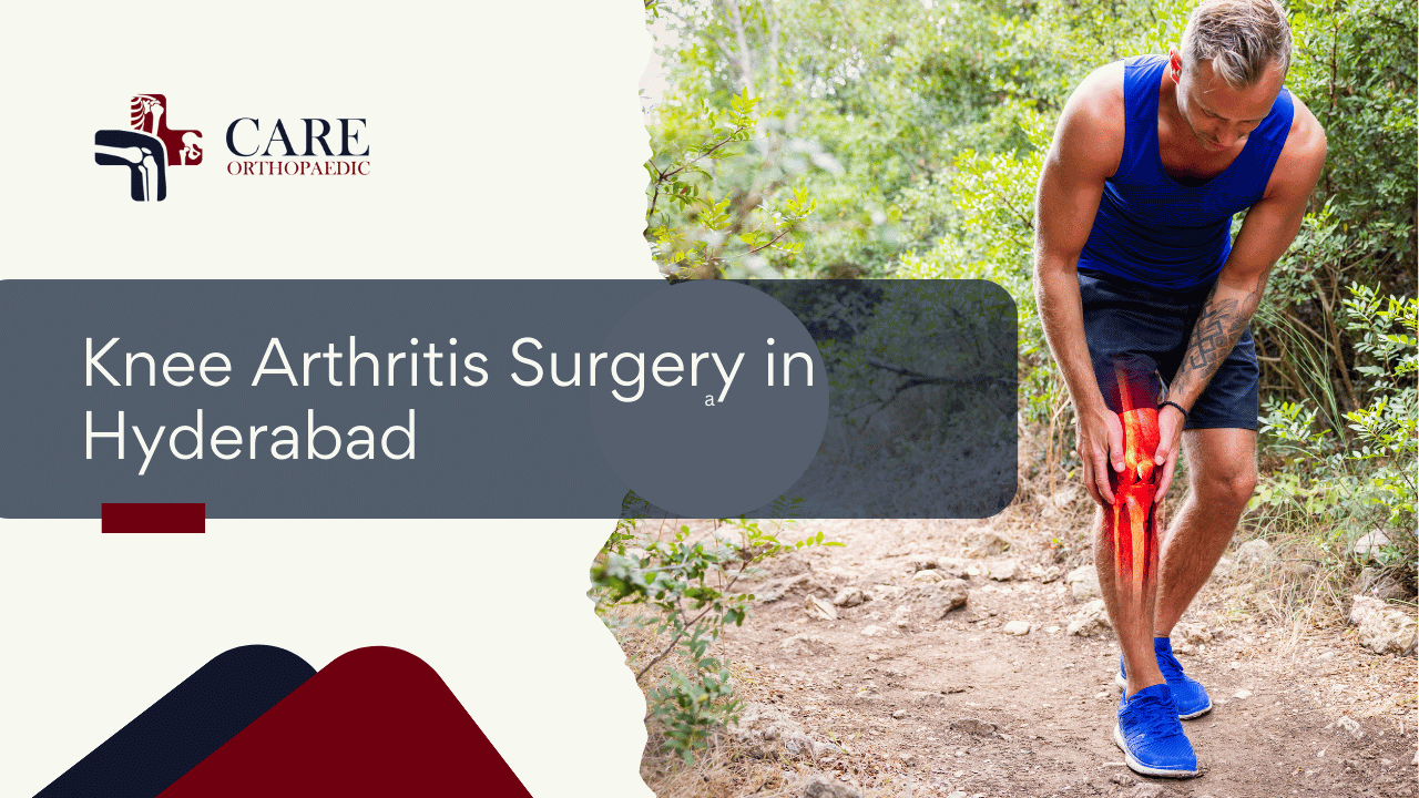 Knee Arthritis Surgery in Hyderabad