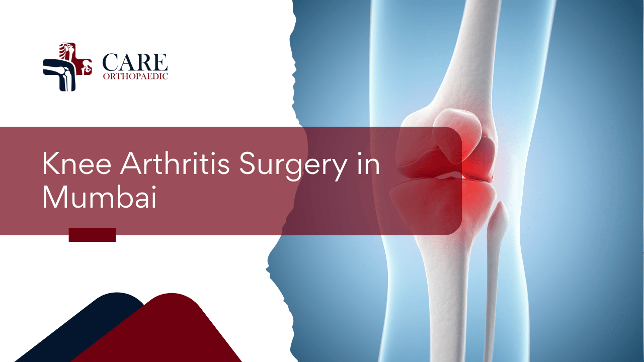 Knee Arthritis Surgery in Mumbai