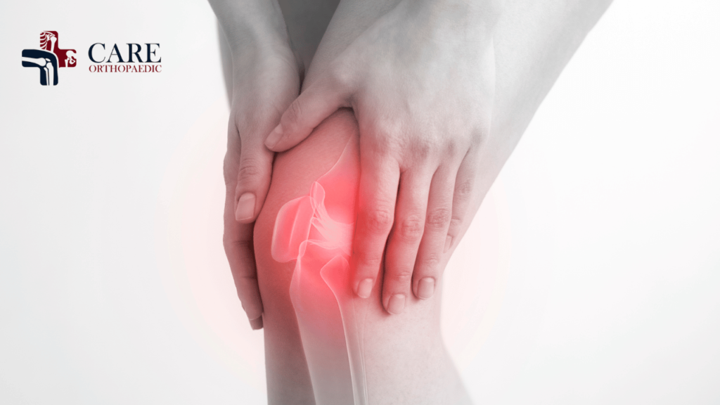 Knee Arthritis Surgery in Bengaluru
