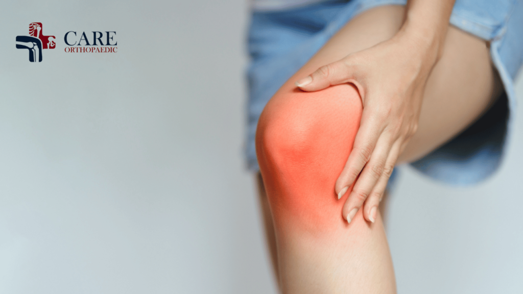 Knee Arthritis Surgery in Delhi