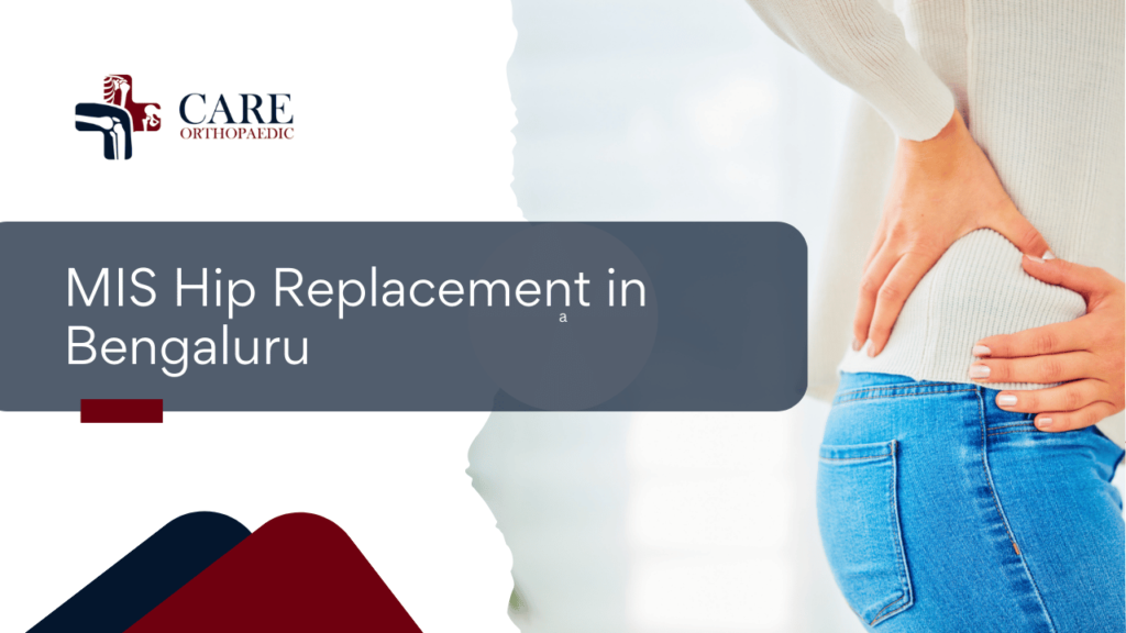 MIS Hip Replacement in Bengaluru